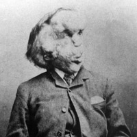 The life of Joseph Merrick – the Elephant Man